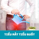 Tiểu rắt tiểu buốt tìm hiểu nguyên nhân và cách điều trị